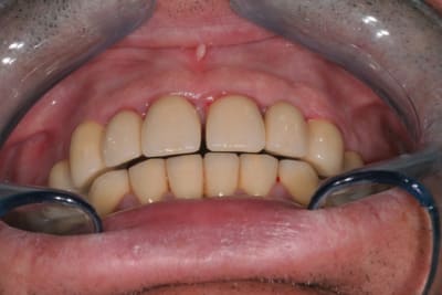 2012 04 18 08 43 30 palu2g - Eugenol