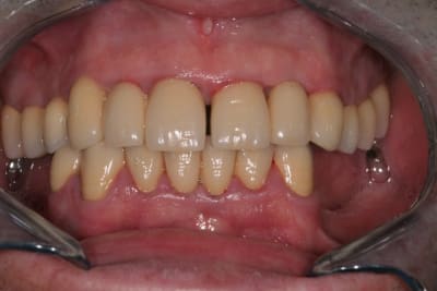 2012 04 18 08 44 19 vxsbbe - Eugenol