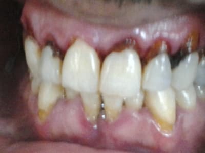 2012 05 29 13.46 - Eugenol