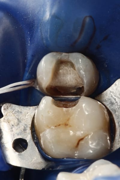 2012 09 06 15.27 - Eugenol