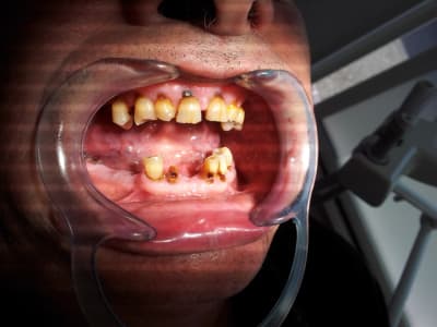 20121004 163013 tn9kbn - Eugenol