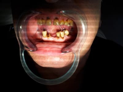 20121004 163052 ywcdvq - Eugenol