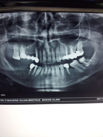 20121210 104515 fxop8r - Eugenol