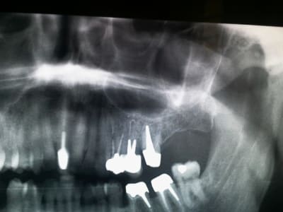 20140115 090401 uuhftf - Eugenol