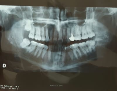 20150619 180420 1 p7yoww - Eugenol