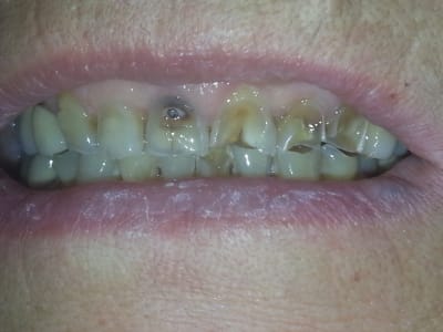 20150717 090811 tzguqw - Eugenol