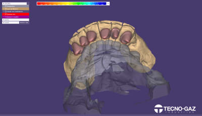 2020 08 25 00007 001 dentalcadscreenshot - Eugenol