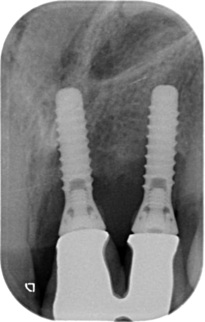 21 22 mhwc07 - Eugenol