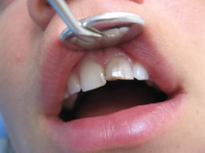 21avant ez9aoe - Eugenol