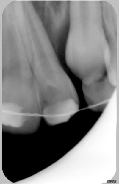 22 21 16 04 2007 k6zjk5 - Eugenol