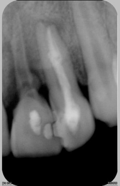 22 21 27 06 2007 dsbitw - Eugenol