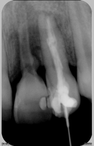 22 21 30 2 2007 lfmunu - Eugenol