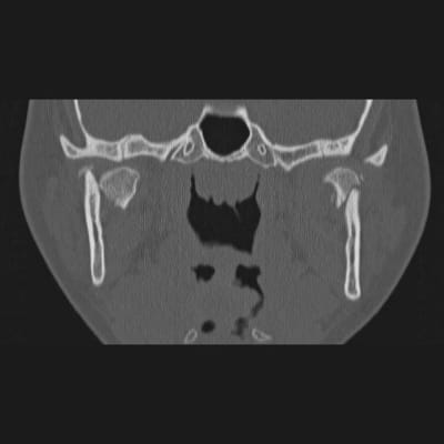 250 kpafze - Eugenol