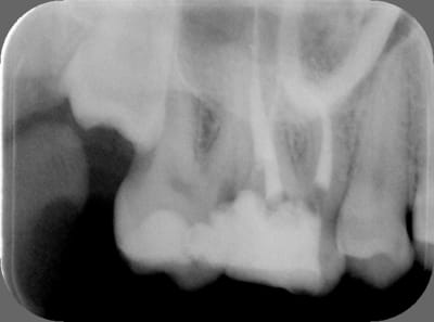 2610 16 20060609 z8ivjn - Eugenol