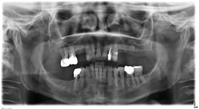26 m 20111007 2723 r2nbfq - Eugenol
