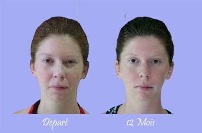 2 visages de face  copie i0t3b1 - Eugenol