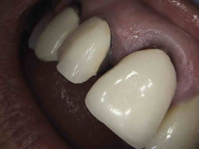 2 plvpyg - Eugenol