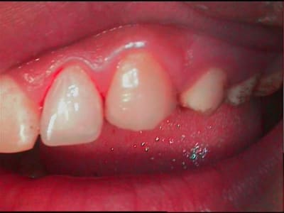 2bis gwdkbq - Eugenol