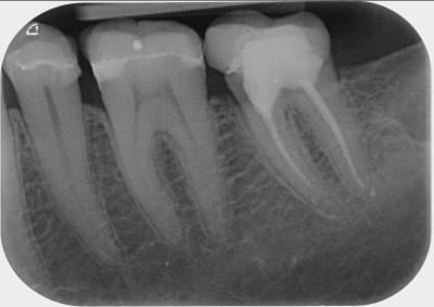 36 37 été 2019 xgzthu - Eugenol