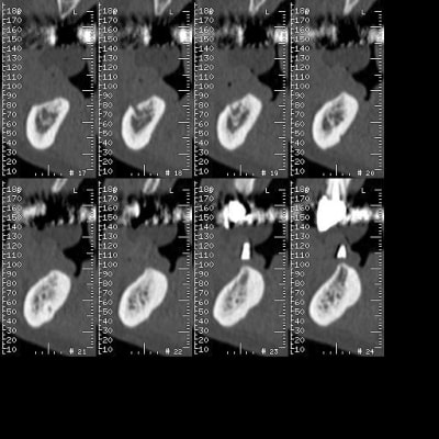 379 qpcjwz - Eugenol