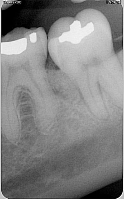 37 apr s fktiho - Eugenol