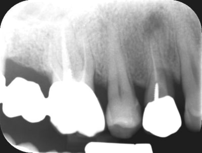 3823 20130802 09 08 19 mrjbvz - Eugenol