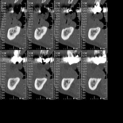 383 cpikcb - Eugenol