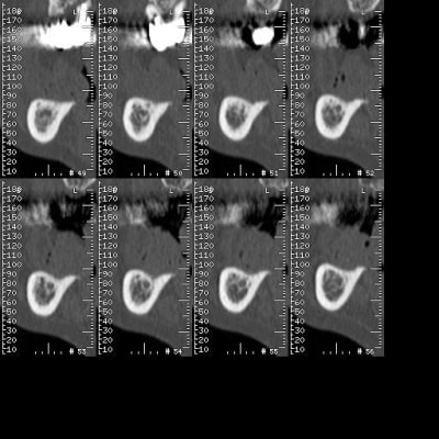 385 yfalzo - Eugenol