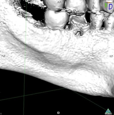 3d3 tthlet - Eugenol