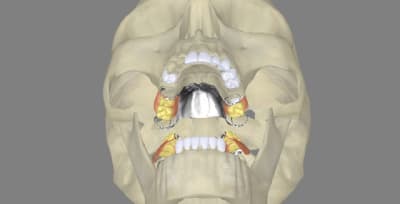 3dscreenshot105 oju9xl - Eugenol