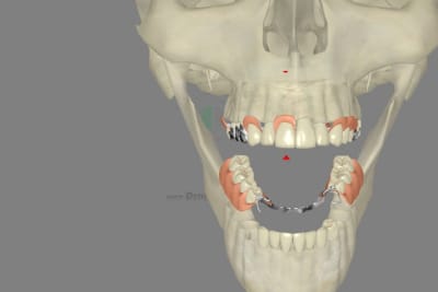 3dscreenshot105 trigvv - Eugenol