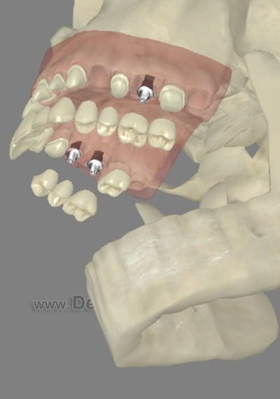 3dscreenshot105 vnilvy - Eugenol