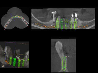 3dslice1 2011 06 19 21 02 47 qlemfv - Eugenol