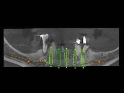 3dslice1 2011 06 19 21 03 22 iccb9s - Eugenol