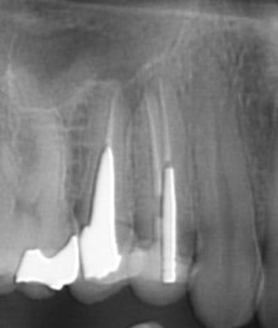 3   03082015 fnfizw - Eugenol