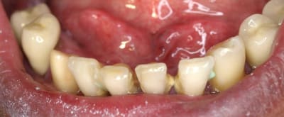 3  3  xv3uir - Eugenol