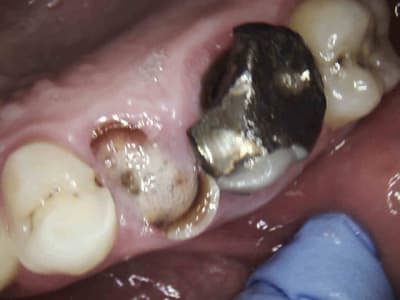 3 hcjbog - Eugenol