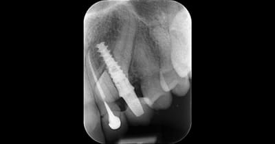 3b4kdca6bxig2am518lqpvuf47g3 - Eugenol