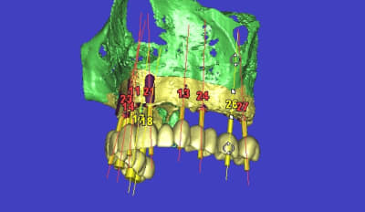 3d14 c7rjrh - Eugenol