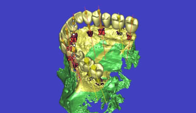 3d16 rkikxt - Eugenol