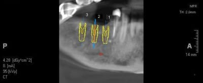 3d3 dh2ukz - Eugenol