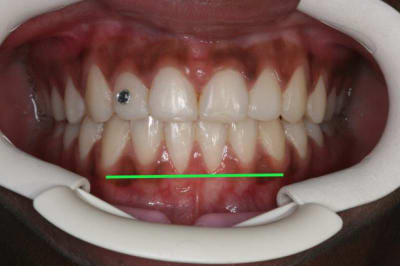41 copie jymuln - Eugenol