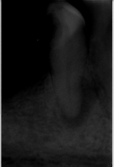 43 av tr ndkjlp - Eugenol