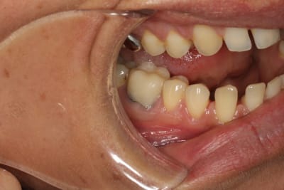 46 emax en place feohua - Eugenol