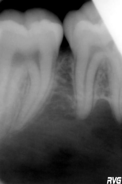 47 46 ewnmw3 - Eugenol