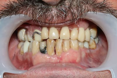 47g591ws44duf24yaekttfbgnh54 - Eugenol