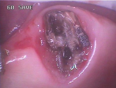 484 gks9r9 - Eugenol