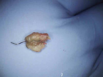 4 kfl8me - Eugenol