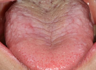 4 xawo8u - Eugenol