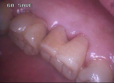 590 qamh57 - Eugenol